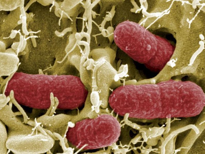 Escherichia coli infekcija Nuotrauka Nr. 3