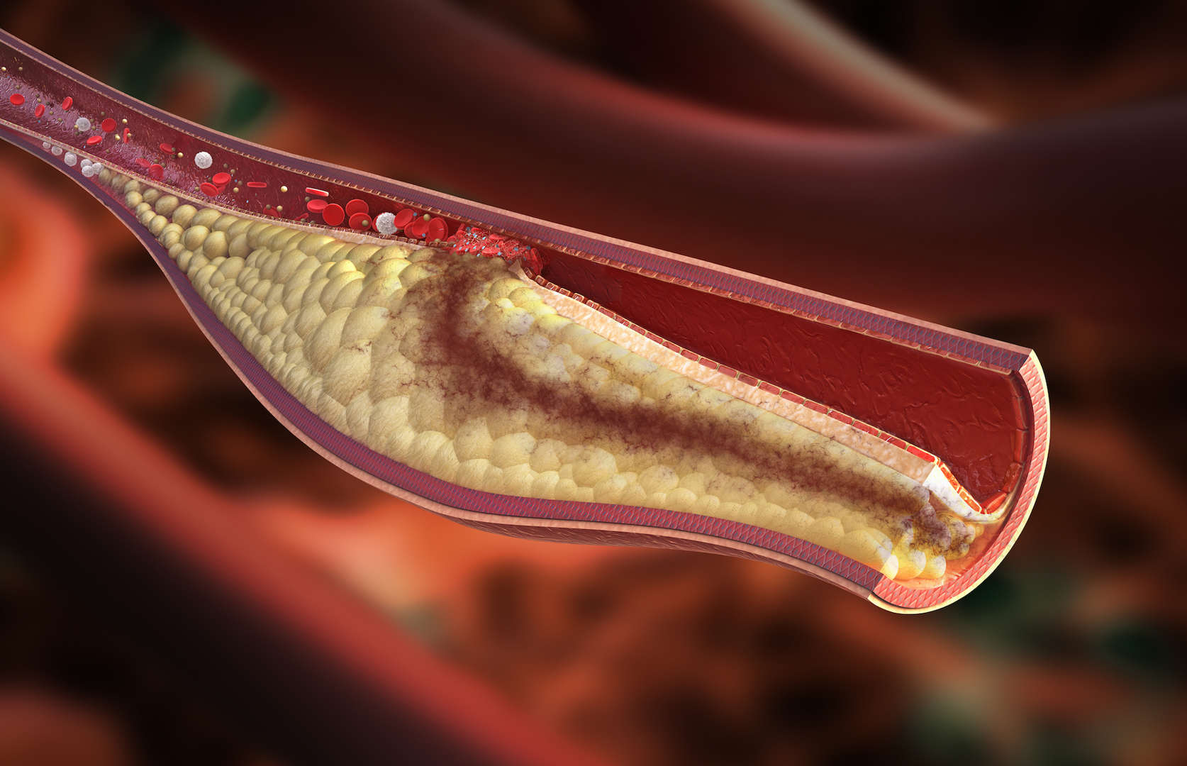 20 svarbių faktų, kuriuos reikia žinoti apie cholesterolį. Kuo skiriasi blogasis ir gerasis cholesterolis?