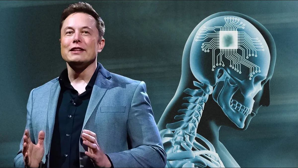Elono Musko smegenų implantas "Neuralink" pradeda klinikinius bandymus su žmonėmis