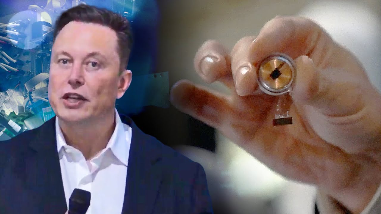 Elono Musko "Neuralink" implantavo smegenų lustą pirmajam žmogui