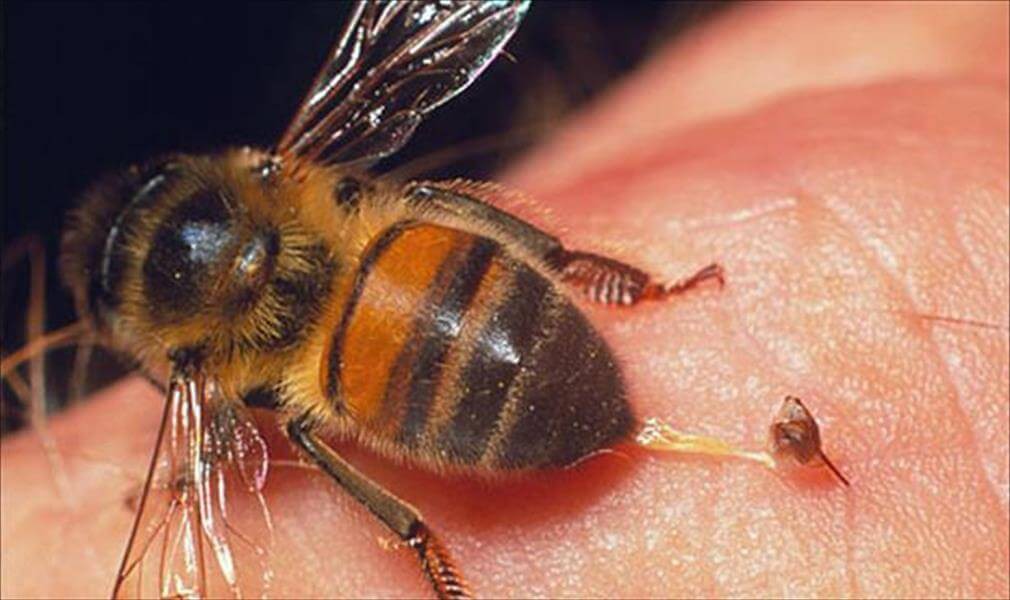 Gydymas bičių nuodais